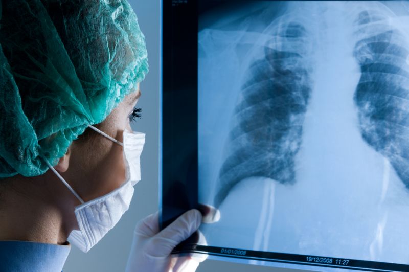 A surgeon wearing a face mask, gown, gloves and a hair cap, looks closely at a lung x-ray image.