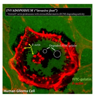 Human Glioma Cell