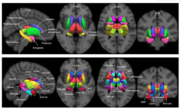 A multiscale group-consensus parcellation atlas derived from 3T-rfMRI acquired in 1,080 healthy adults