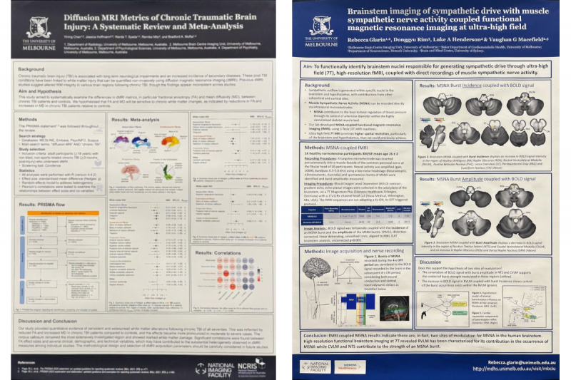 Posters submitted by the MBCIU to OHBM 2025.