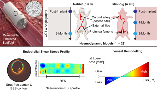 Pictured: The RFS was tested in rabbit and mini-pig arteries over three months. Imaging and computer modelling showed a smooth blood-flow environment linked with vessel wall remodelling. Colour maps show endothelial shear stress (ESS), the frictional force of blood on the artery wall, a key driver of vascular healing. Reproduced from Hatzikostas et al., Frontiers in Cardiovascular Medicine, 2026.
