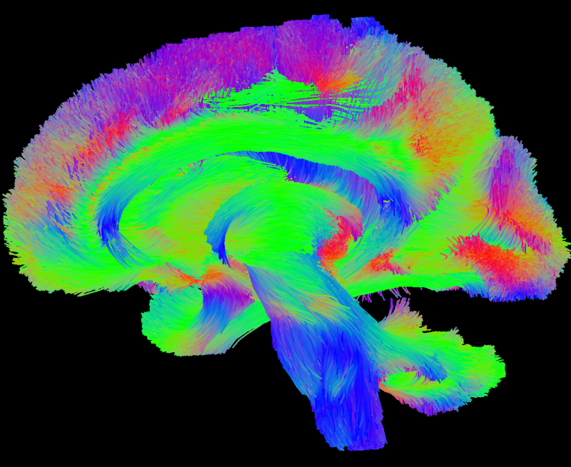 Research Highlights Brain Imaging