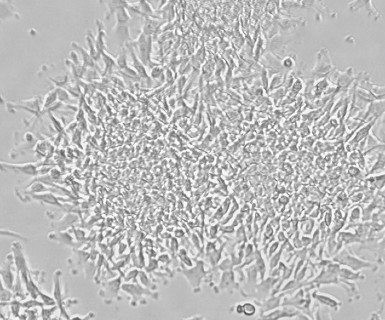 Human Glioma Stem Cells